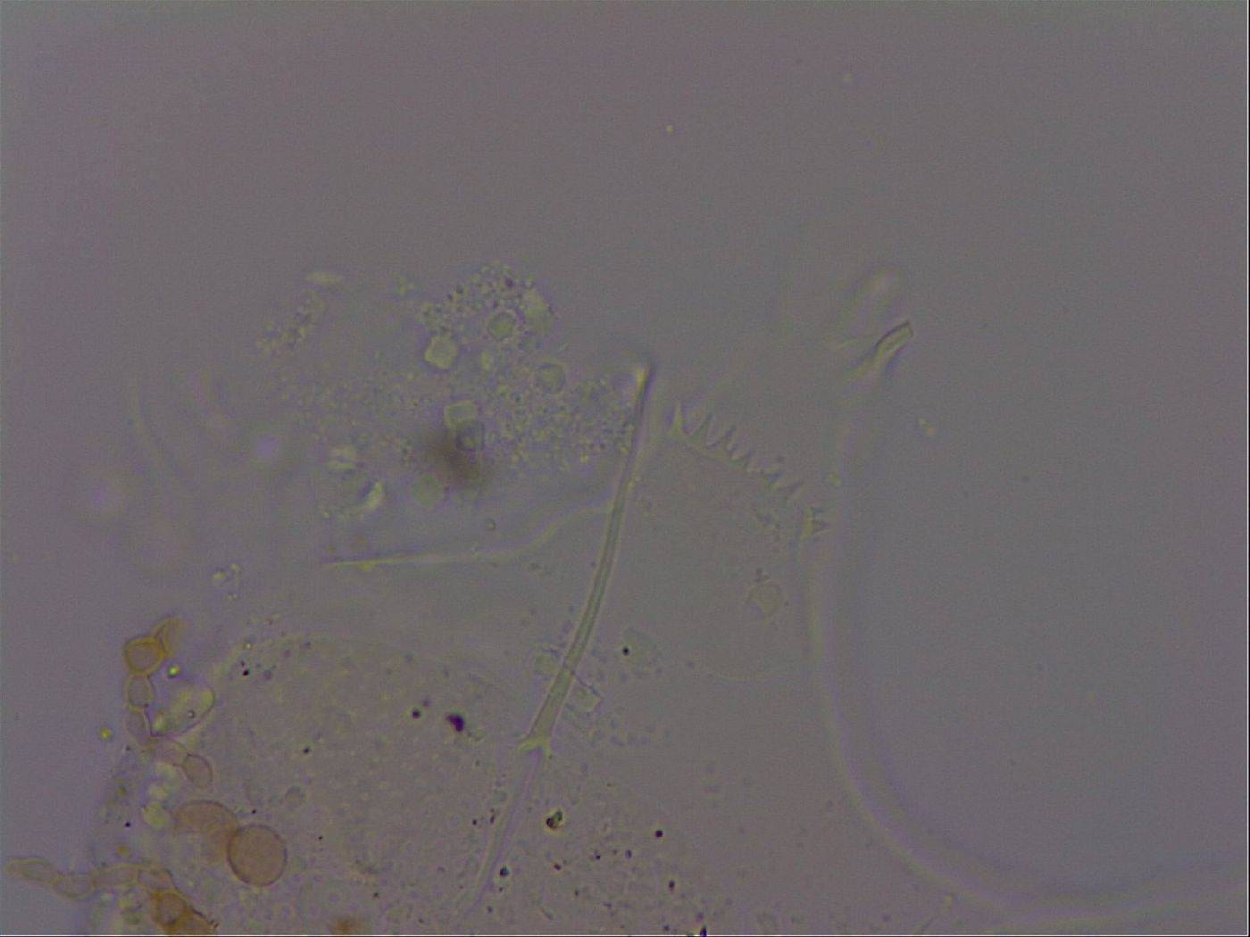 Echiniscus quadrispinosus image