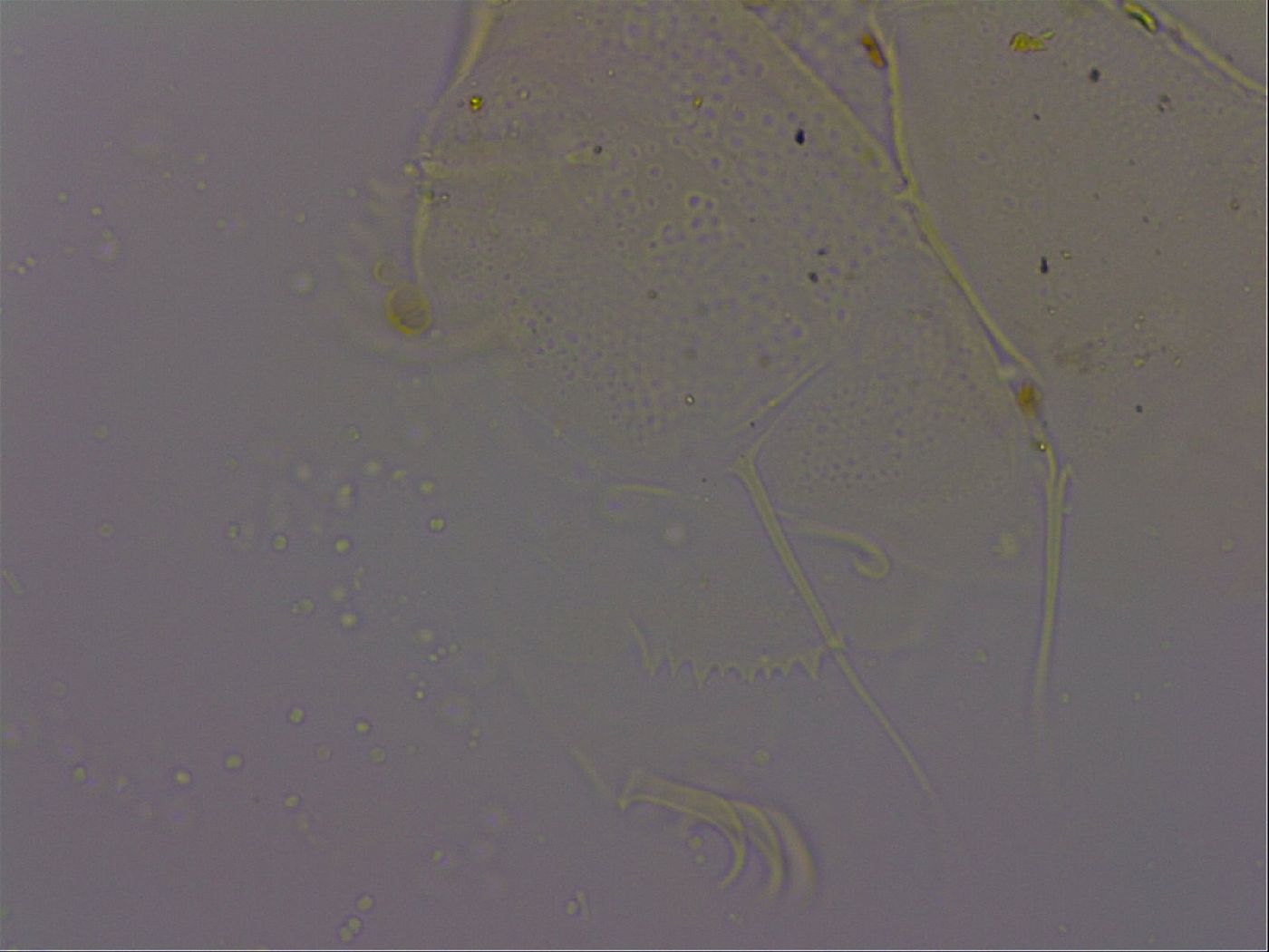 Echiniscus quadrispinosus image