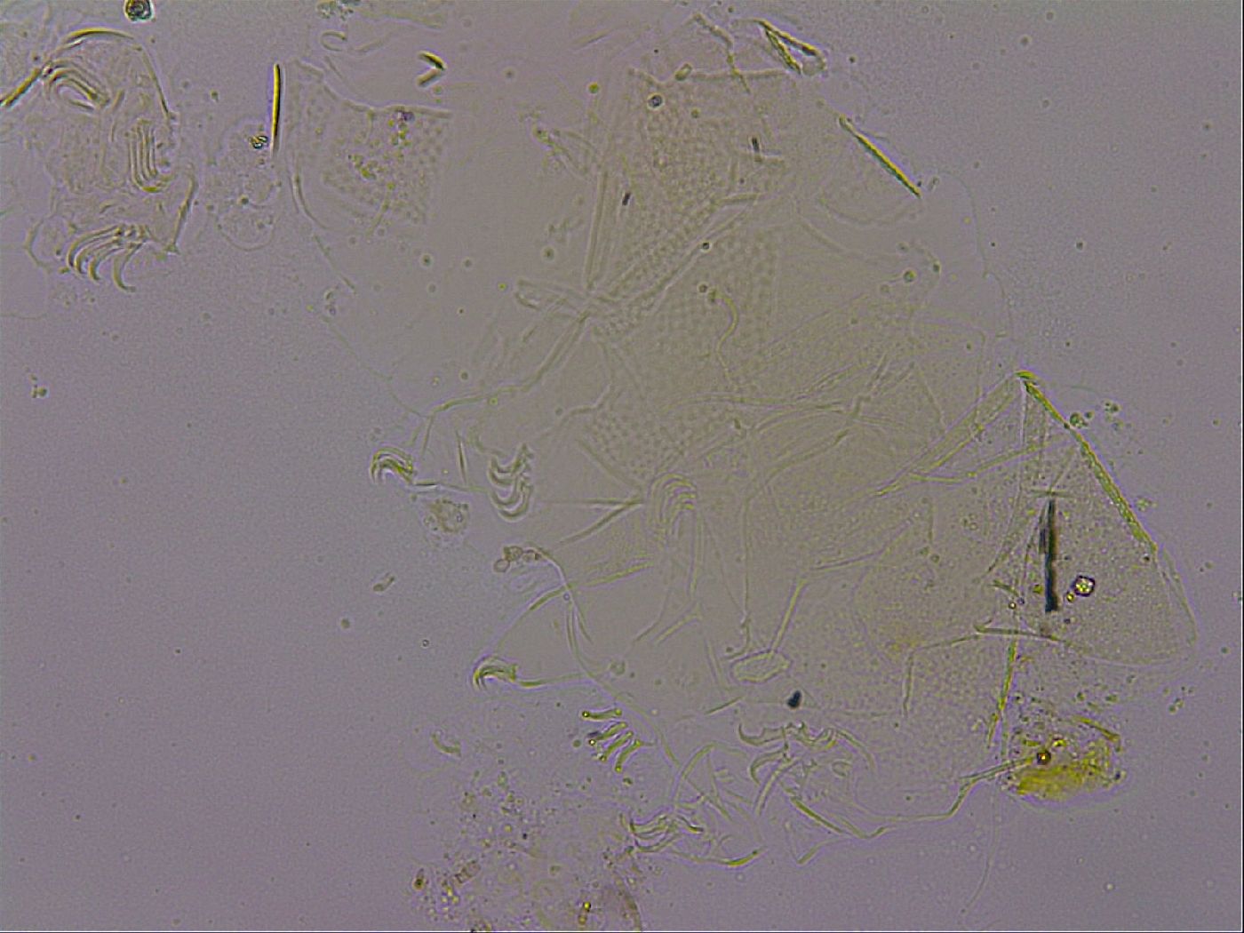 Echiniscus quadrispinosus image