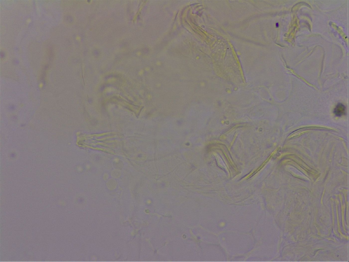Echiniscus quadrispinosus image
