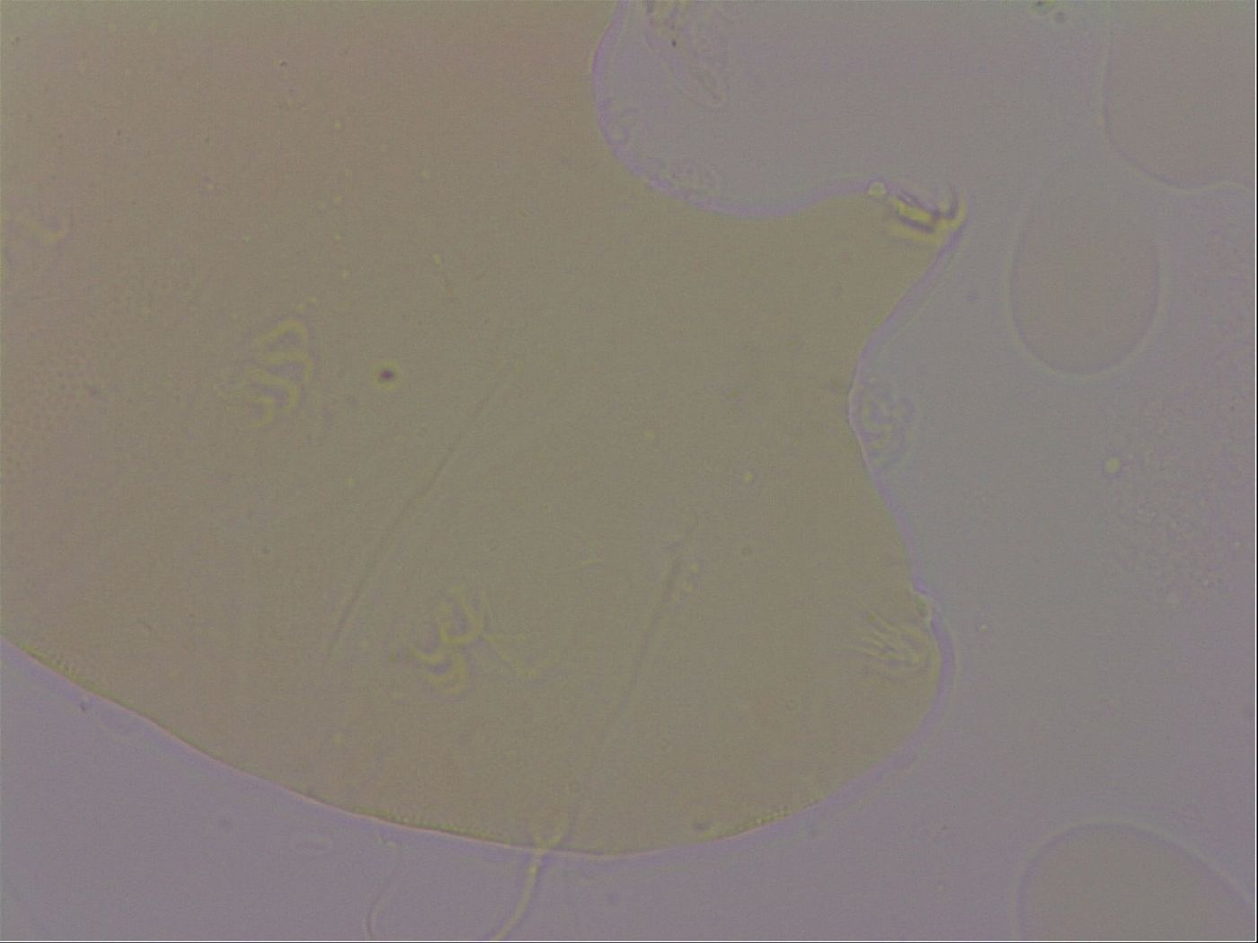 Echiniscus robertsi image