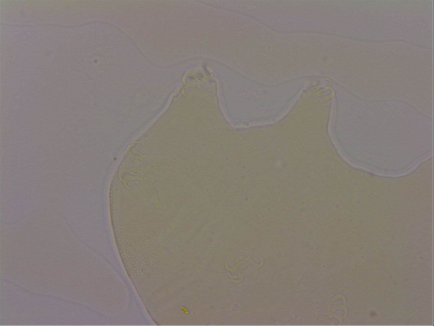 Echiniscus robertsi image