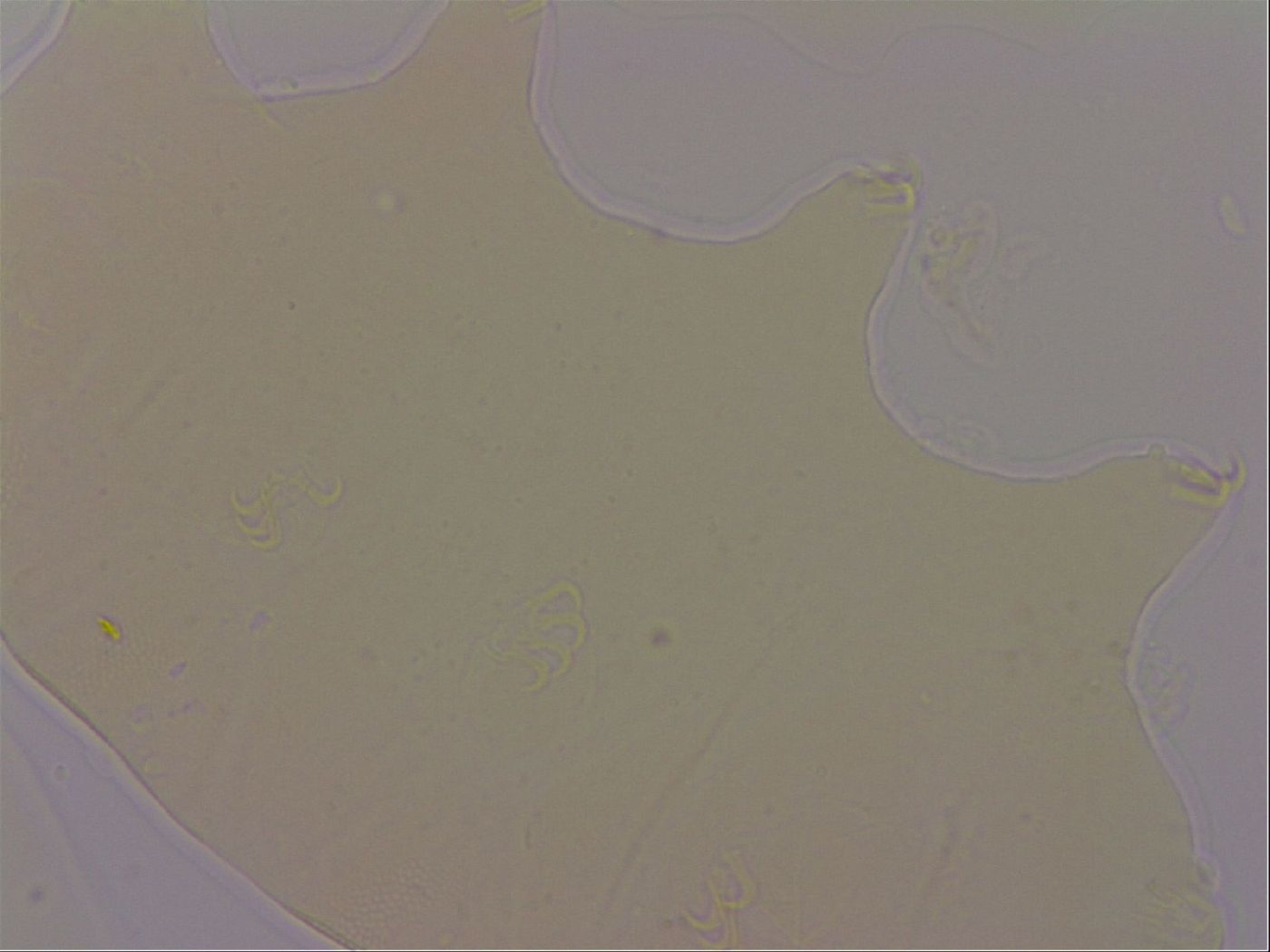 Echiniscus robertsi image