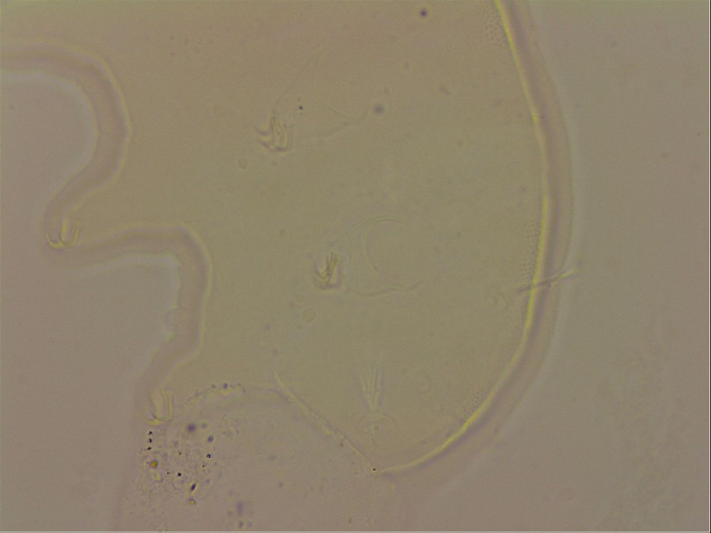 Echiniscus robertsi image