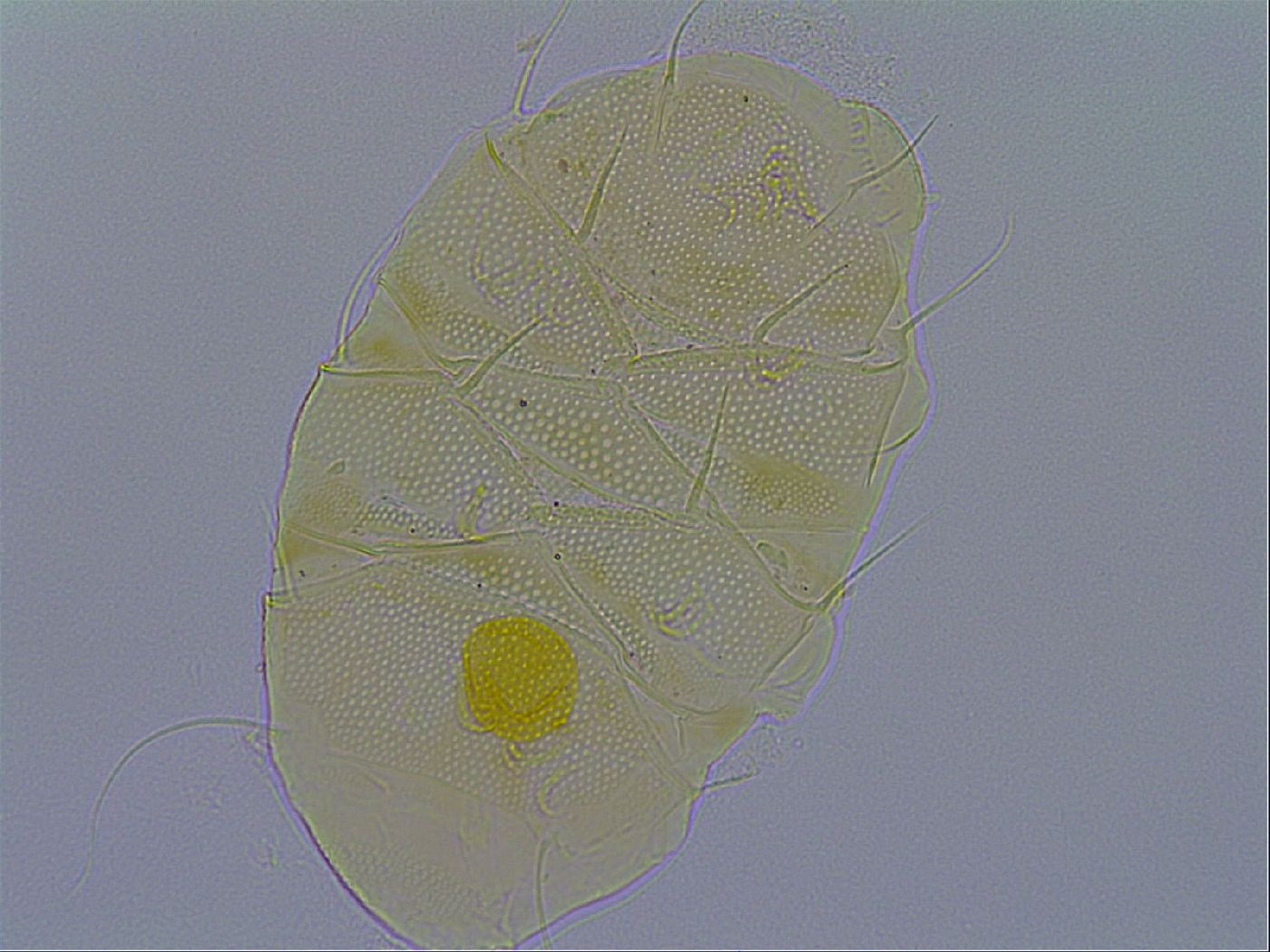 Echiniscus spiniger image