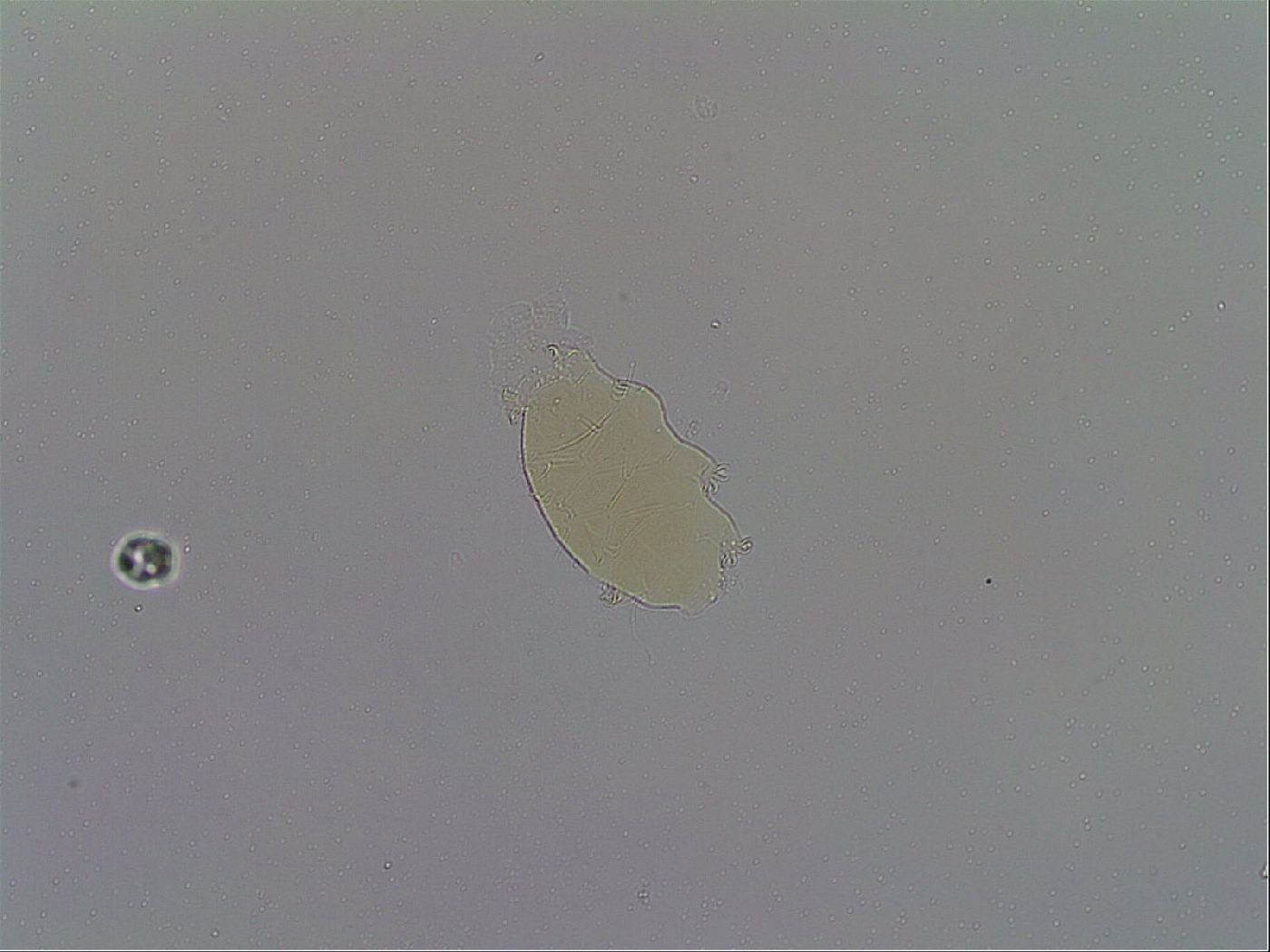 Echiniscus spiniger image