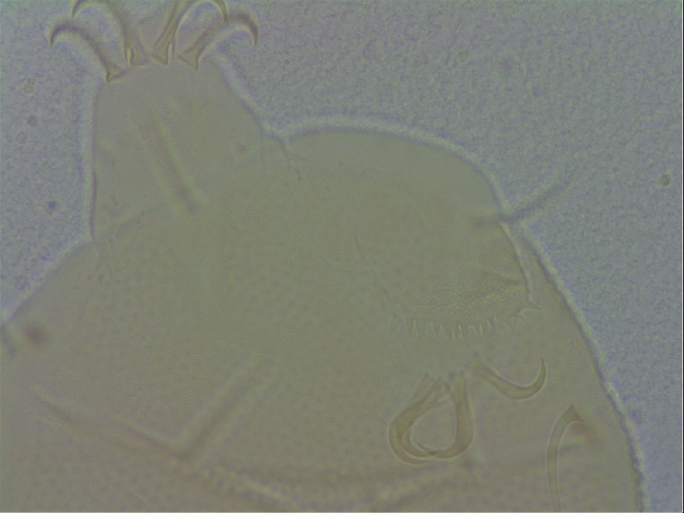 Echiniscus spiniger image
