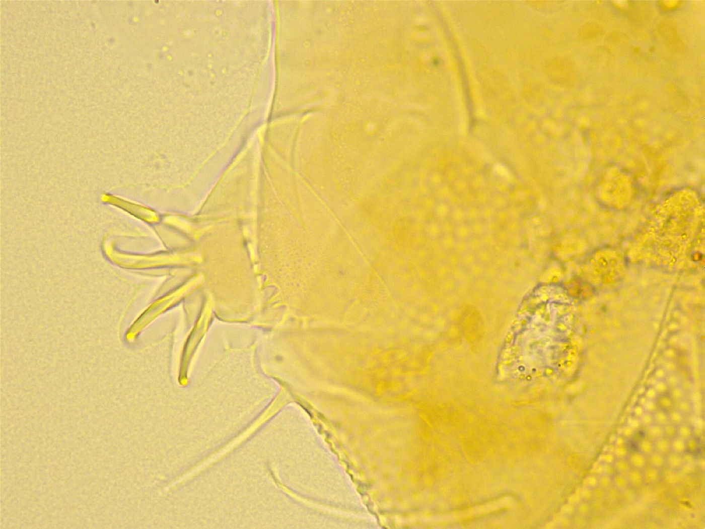 Echiniscus spiniger image