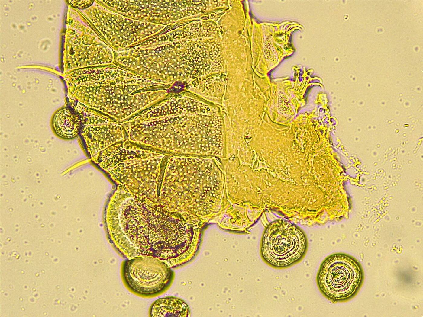 Echiniscus spinulosus image