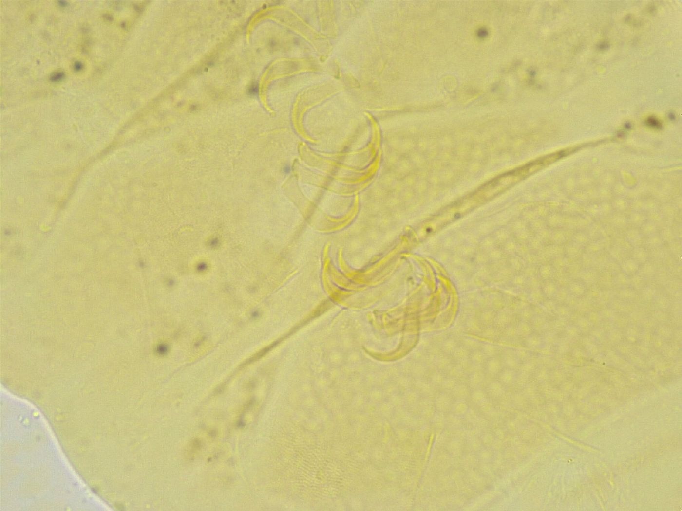 Echiniscus tamus image