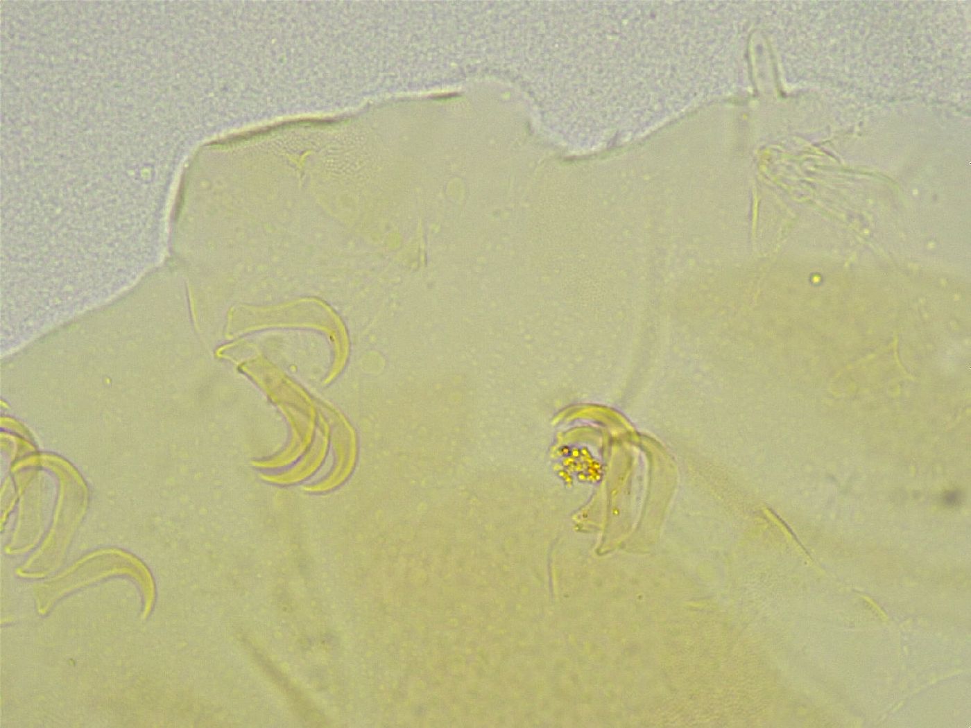Echiniscus tamus image