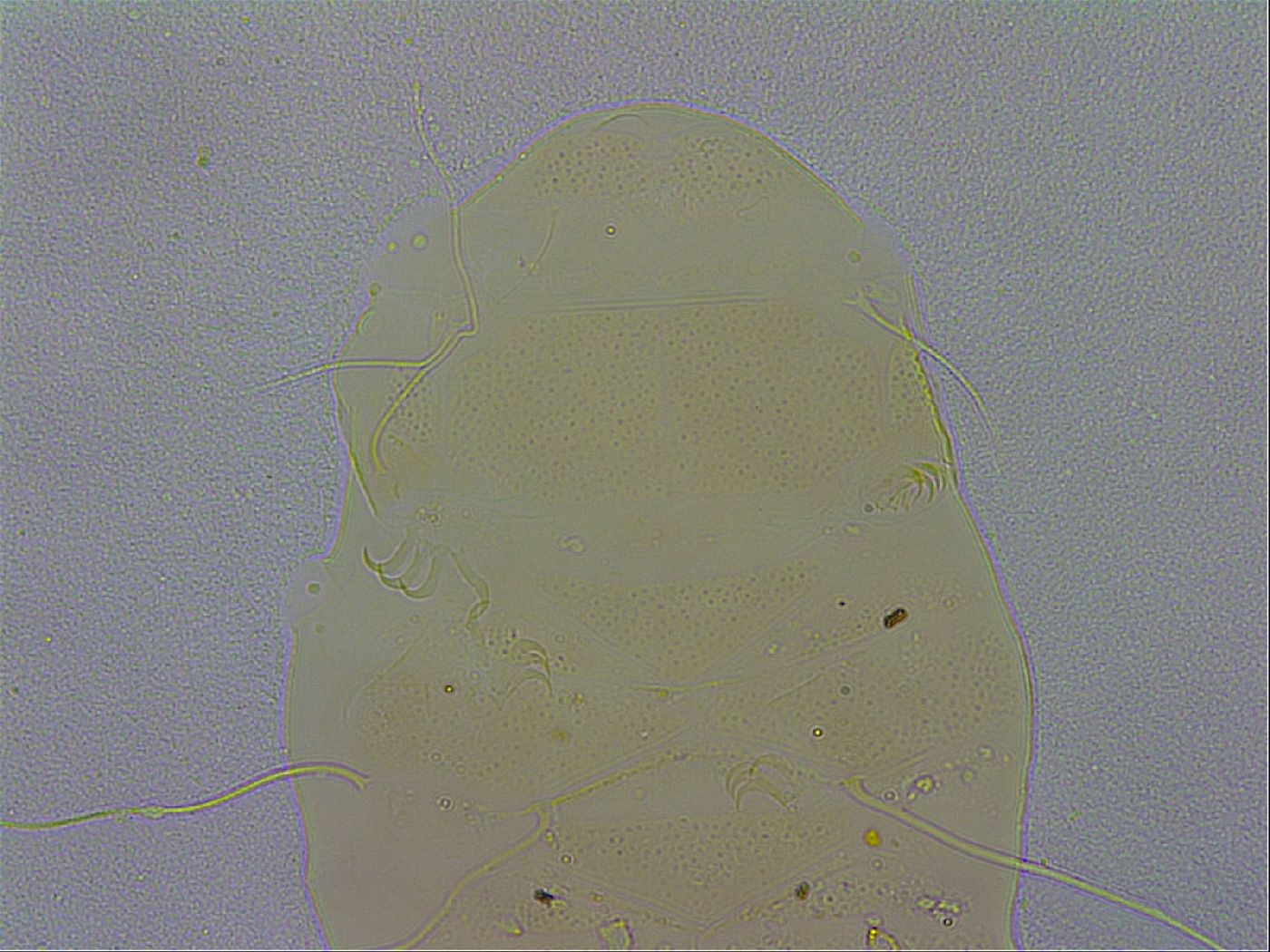 Echiniscus zetotrymus image