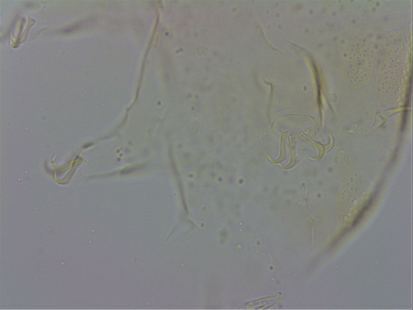 Echiniscus zetotrymus image