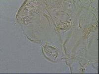 Testechiniscus laterculus image