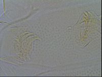 Testechiniscus laterculus image