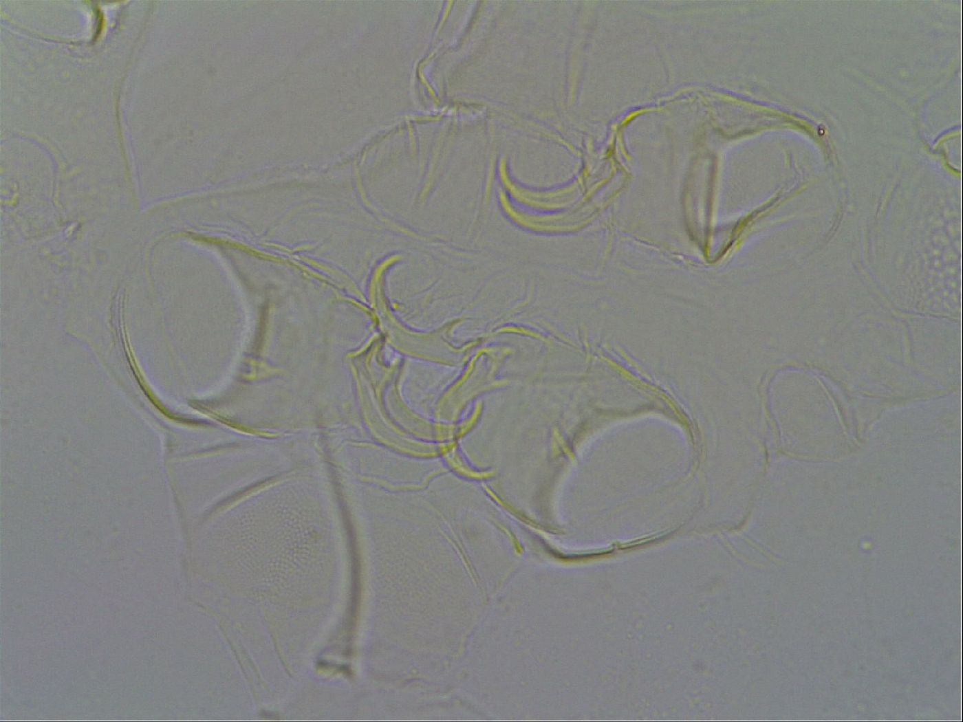 Testechiniscus laterculus image