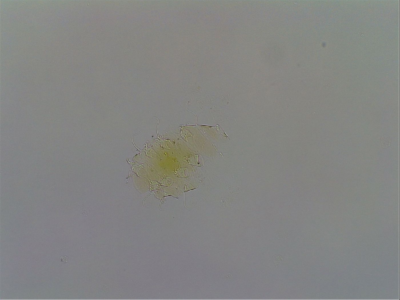 Testechiniscus laterculus image