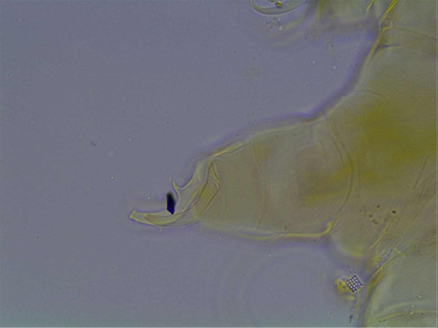 Testechiniscus laterculus image