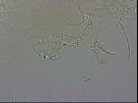 Testechiniscus laterculus image