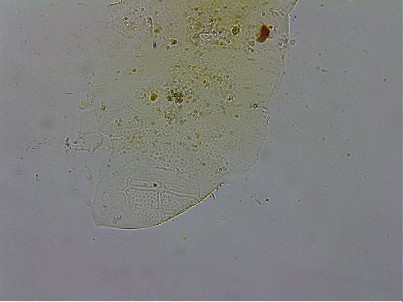 Echiniscus testudo image