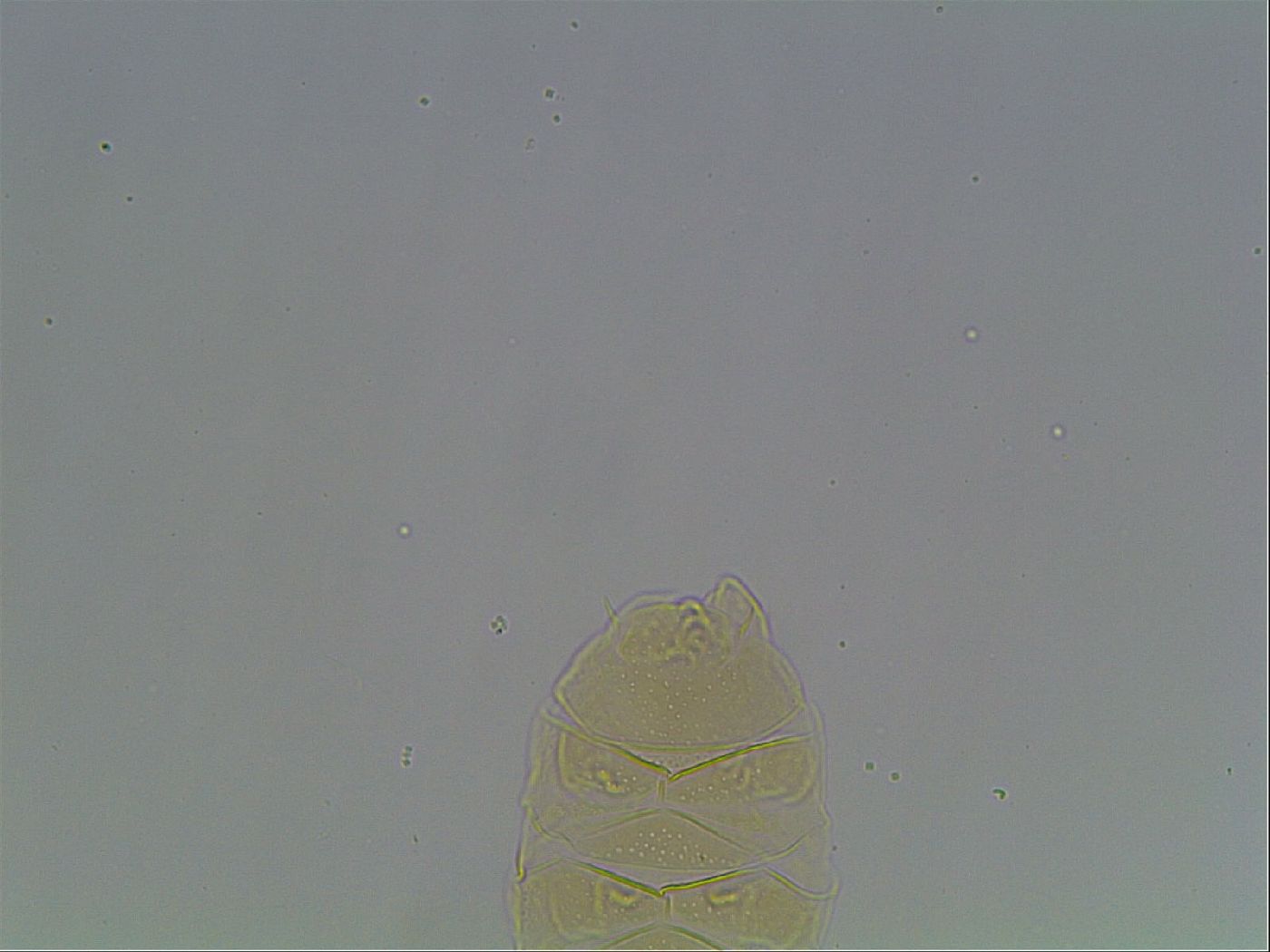 Echiniscus cavagnaroi image