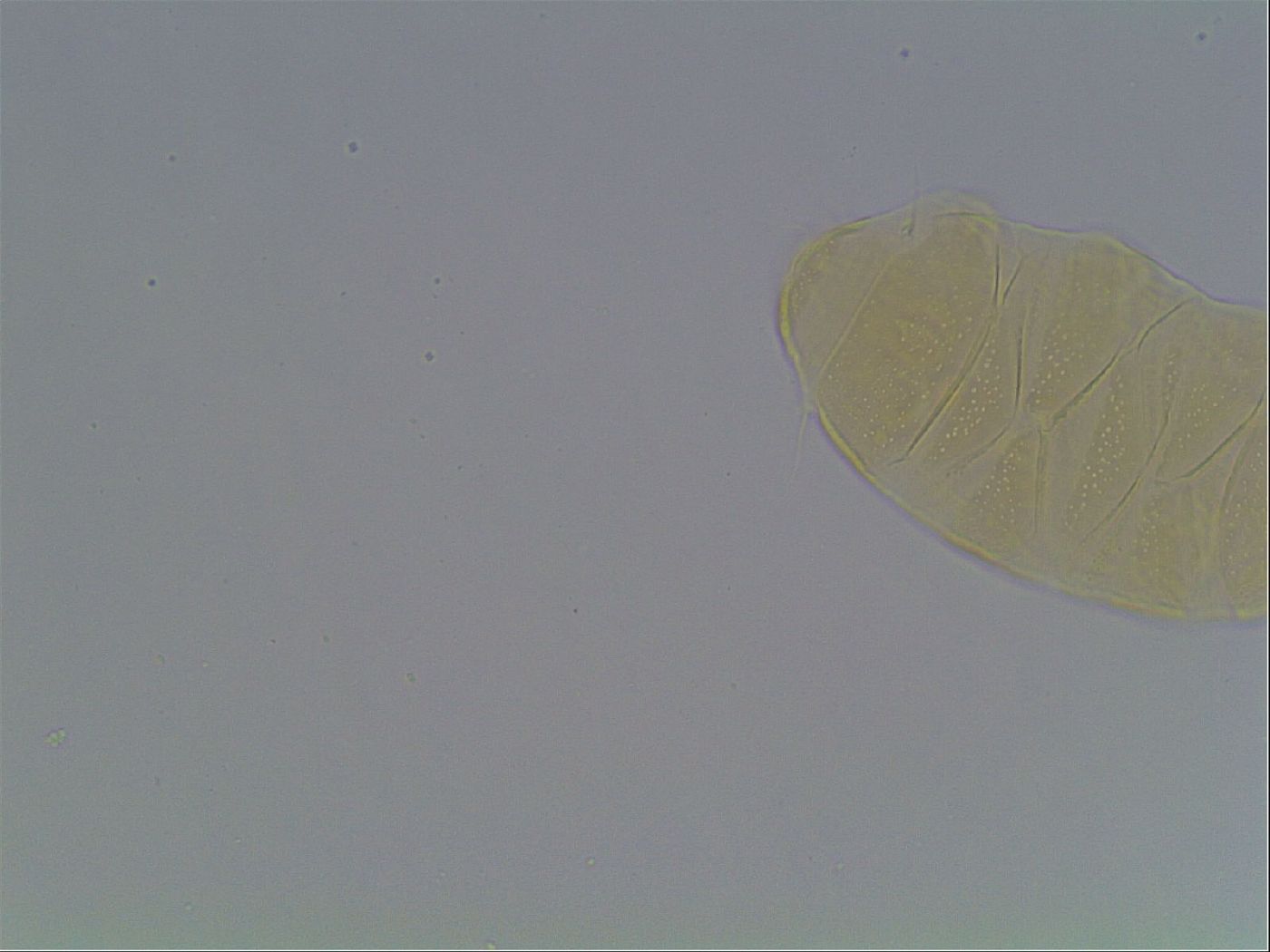 Echiniscus cavagnaroi image