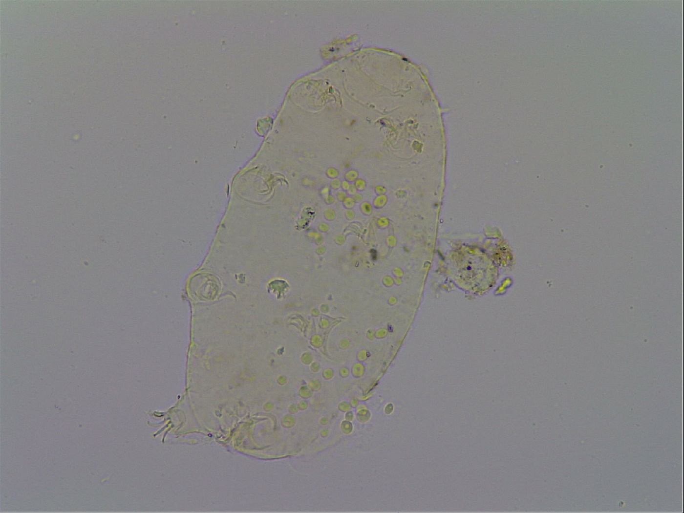 Echiniscus pseudelegans image