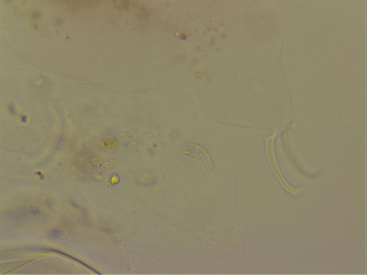 Haplomacrobiotus hermosillensis image