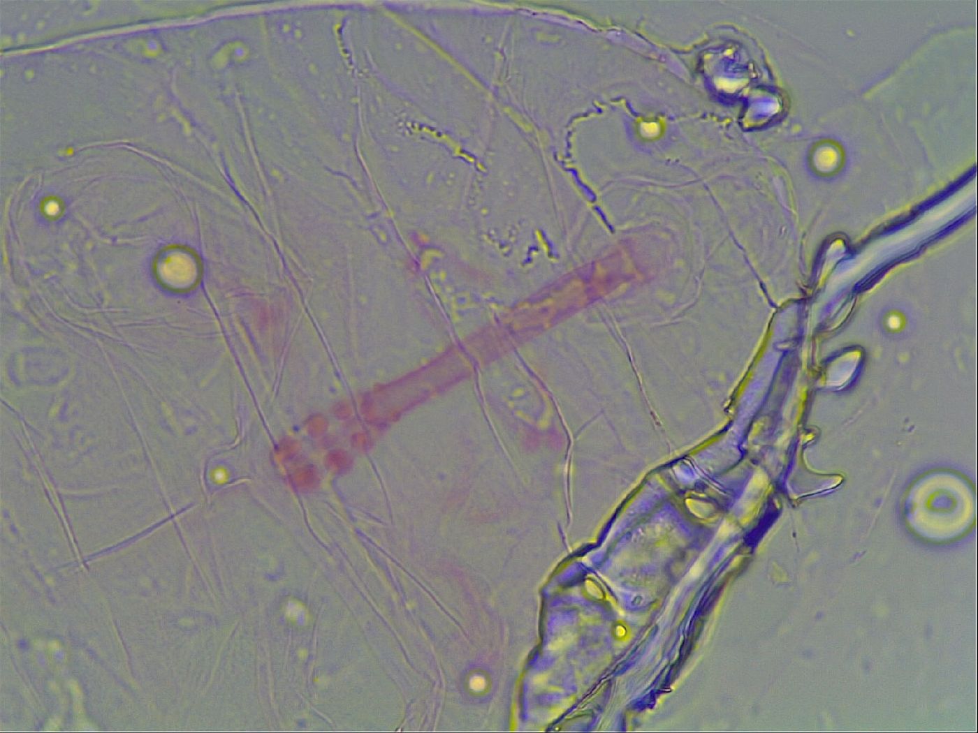Haplomacrobiotus image