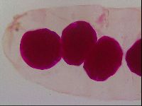 Haplomacrobiotus hermosillensis image