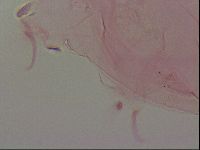 Haplomacrobiotus hermosillensis image