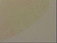 Ramazzottius oberhaeuseri image