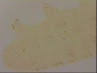 Ramazzottius oberhaeuseri image