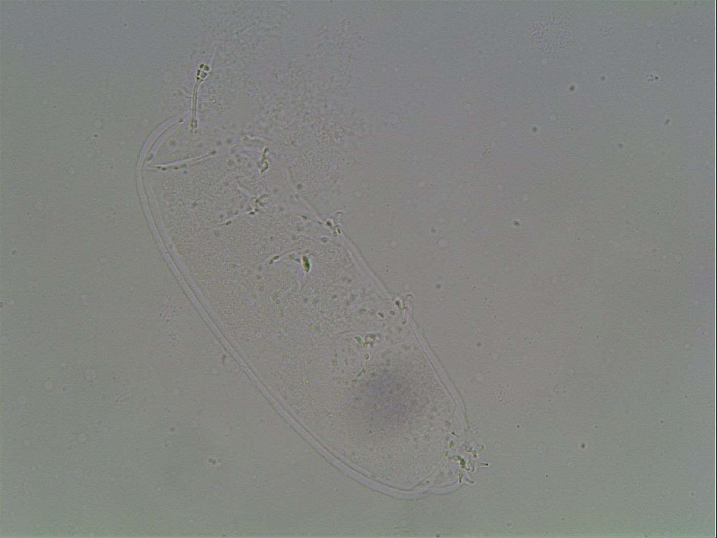 Hypsibius convergens image