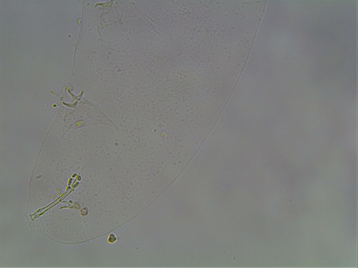 Hypsibius convergens image
