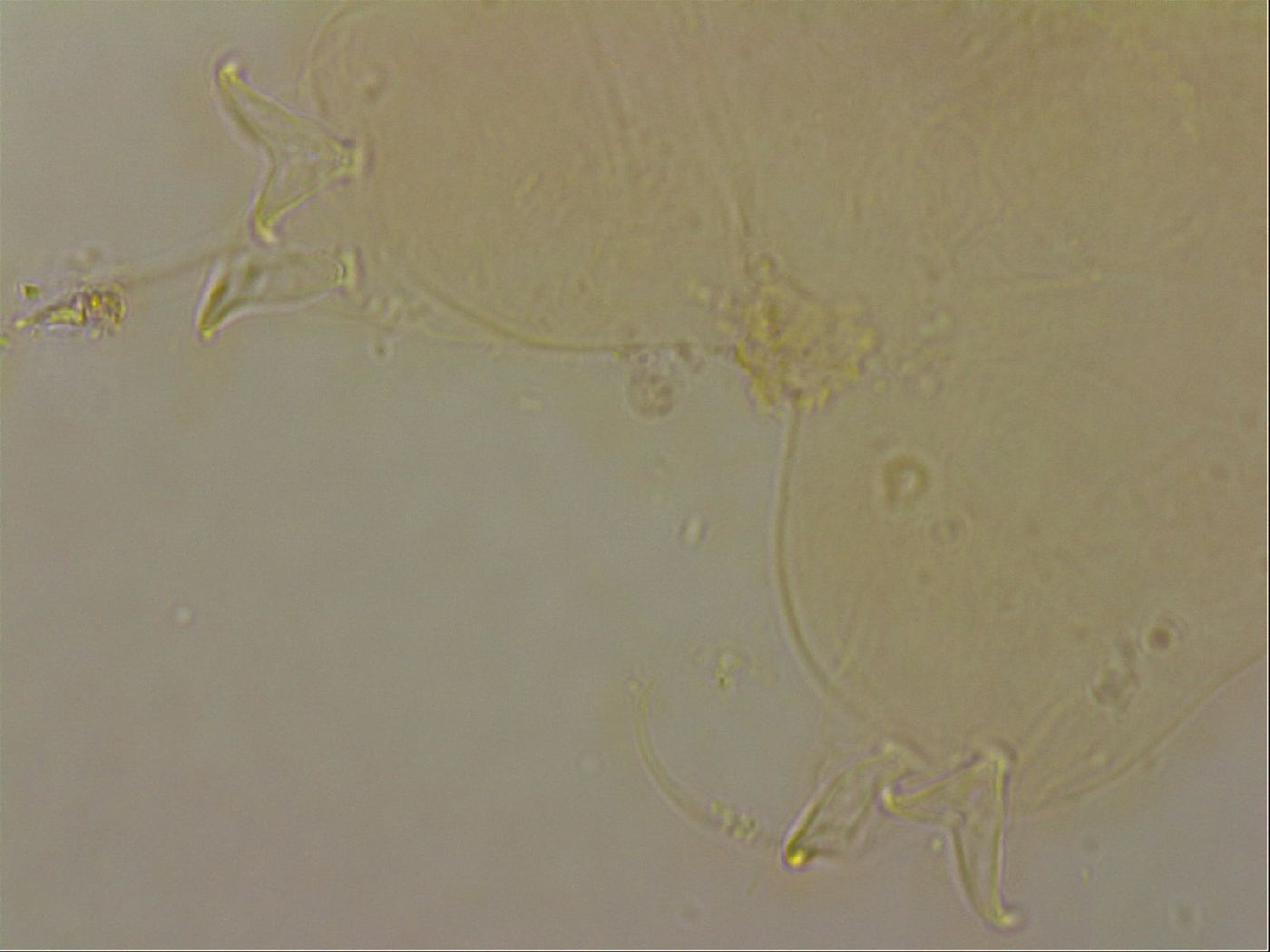 Ramazzottius oberhaeuseri image