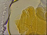 Ramazzottius oberhaeuseri image