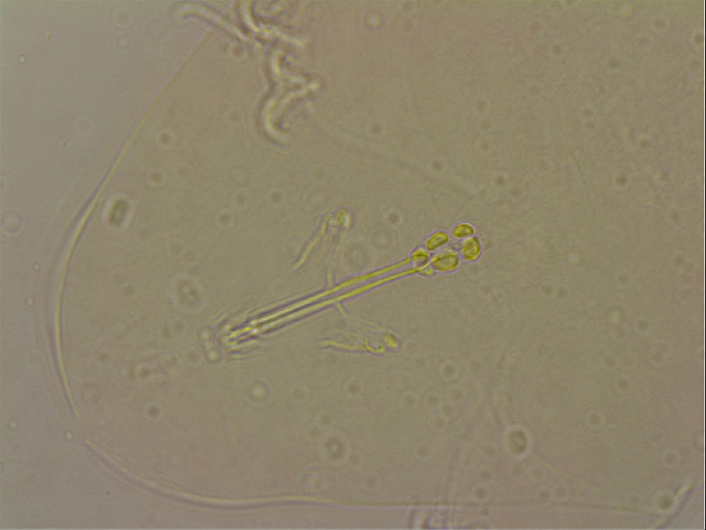 Ramazzottius oberhaeuseri image