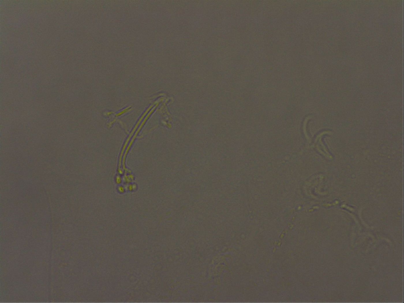 Ramazzottius oberhaeuseri image