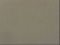 Ramazzottius oberhaeuseri image