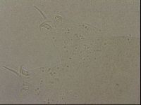 Ramazzottius oberhaeuseri image