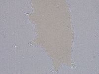 Ramazzottius oberhaeuseri image