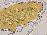 Ramazzottius oberhaeuseri image
