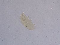Ramazzottius oberhaeuseri image