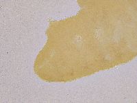 Ramazzottius oberhaeuseri image