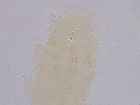 Ramazzottius oberhaeuseri image