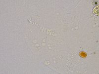 Ramazzottius oberhaeuseri image
