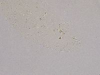 Ramazzottius oberhaeuseri image