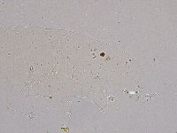 Ramazzottius oberhaeuseri image