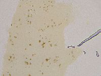 Ramazzottius oberhaeuseri image